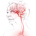 Sketch of blood flow to the brain